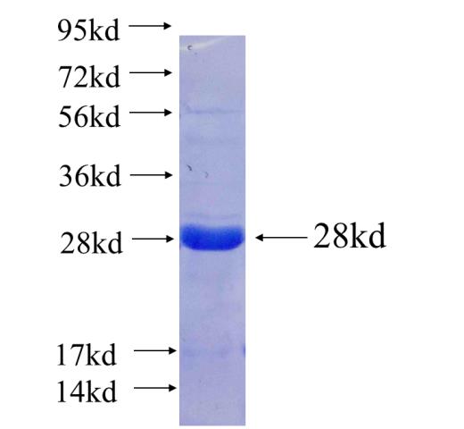 Recombinant human MYL4(Full length) SDS-PAGE