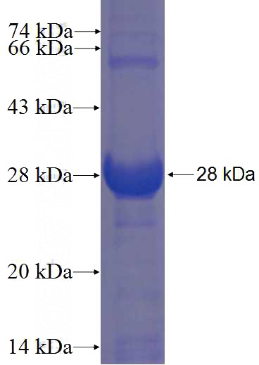 Recombinant Human C1orf84 SDS-PAGE