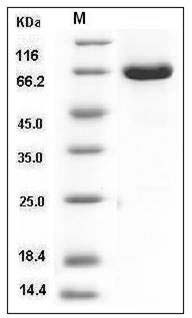 Human ERK2 / MAPK1 / MAPK2 Protein (GST Tag) SDS-PAGE