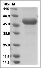 Mouse Tnfrsf26 / Tumor necrosis factor receptor superfamily member 26 Protein (Fc Tag) SDS-PAGE