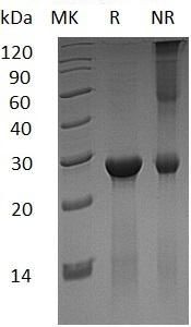 Human ASB13 (His tag) recombinant protein