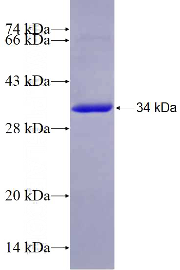 Recombinant Human ZNF266 SDS-PAGE