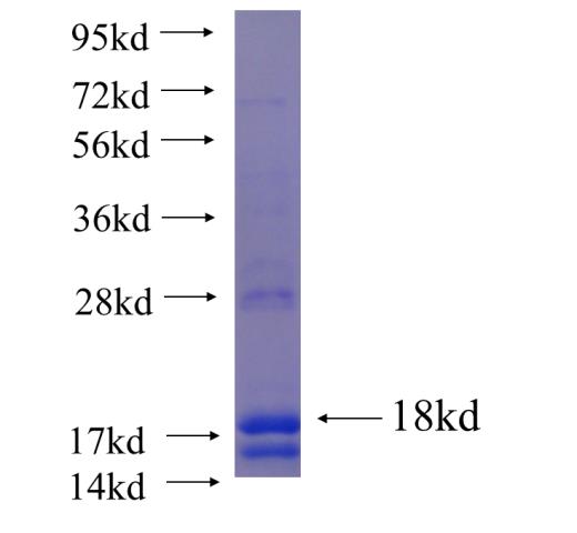Recombinant human DRD1 SDS-PAGE