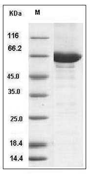 Mouse CSK / C-Src kinase Protein (His & GST Tag) SDS-PAGE