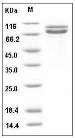 Human N-Cadherin / CD325 / CDH2D Protein (His Tag) SDS-PAGE