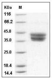 Mouse CD157 / BST1 Protein (His Tag) SDS-PAGE