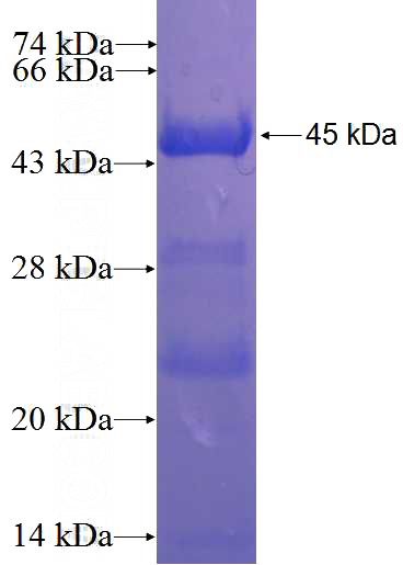 Recombinant Human C2orf86 SDS-PAGE