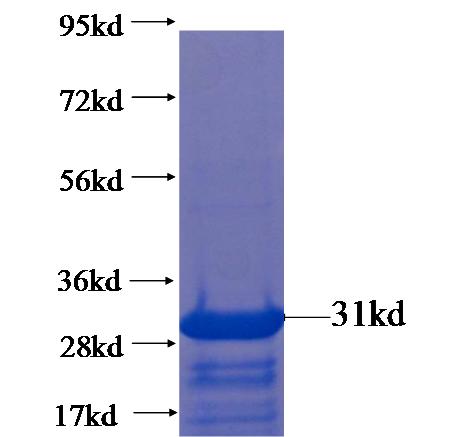 Recombinant human C18orf21(Full length) SDS-PAGE