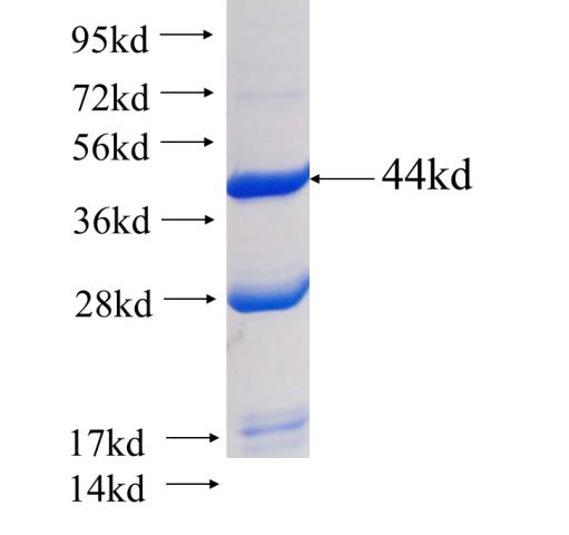 Recombinant human ISCU SDS-PAGE
