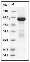 Human TRIB2 / TRB2 Protein (His & GST Tag) SDS-PAGE