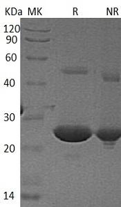Human LYPLA1/APT1/LPL1 (His tag) recombinant protein