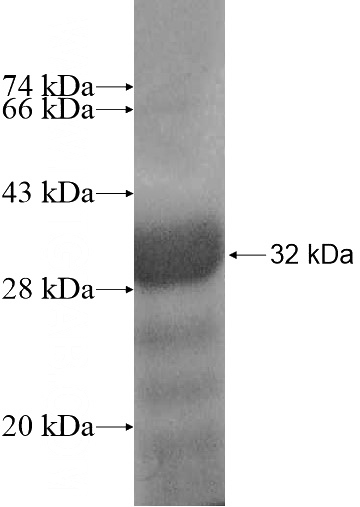 Recombinant Human PRR7 SDS-PAGE
