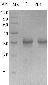 Human FGF17/UNQ161/PRO187 (His tag) recombinant protein