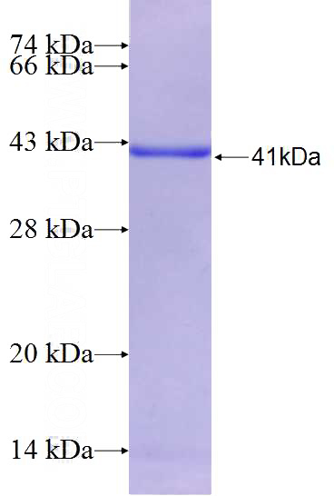 Recombinant Human CASQ2 SDS-PAGE