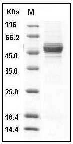 Rat GPT2 Protein (His Tag) SDS-PAGE