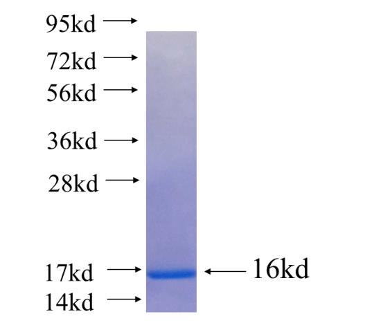 Recombinant human GPR105 SDS-PAGE