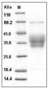Mouse Ephrin-B2 / EFNB2 Protein (His Tag) SDS-PAGE