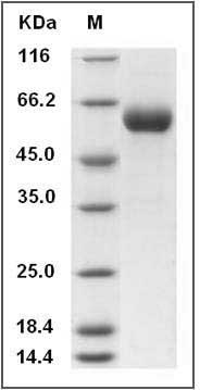 Human SerpinC1 / AntithrombinIII / ATIII Protein (His Tag) SDS-PAGE
