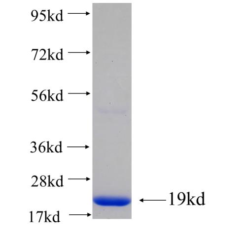 Recombinant human C11orf67(Full length) SDS-PAGE