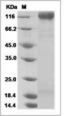 GP120 protein SDS-PAGE