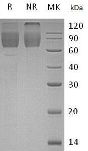 Human SCARB2/CD36L2/LIMP2/LIMPII (His tag) recombinant protein