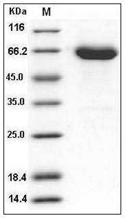 Mouse EphA6 / EHK-2 Protein (His Tag) SDS-PAGE