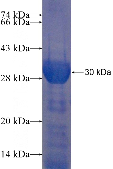 Recombinant Human PACRGL SDS-PAGE