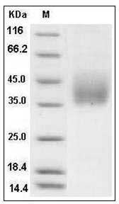 Rat Growth Hormone Receptor / GHR / GHBP Protein (His Tag) SDS-PAGE