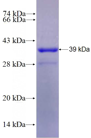 Recombinant Human PTPRK SDS-PAGE