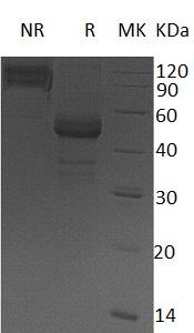 Human TDGF1/CRIPTO (Fc tag) recombinant protein