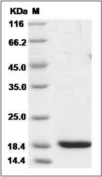 Mouse REG3B / Pap1 Protein (His Tag) SDS-PAGE