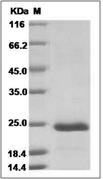 Human CLEC3B / Tetranectin Protein (His Tag) SDS-PAGE