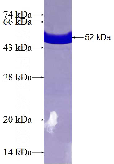 Recombinant Human YWHAZ SDS-PAGE