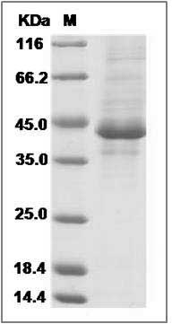 Human FAM19A4 / TAFA4 Protein (Fc Tag) SDS-PAGE