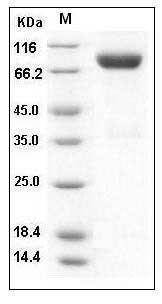 Mouse IL2RG Protein (His & Fc Tag) SDS-PAGE