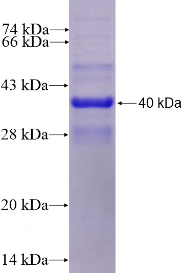 Recombinant Human CNR1 SDS-PAGE
