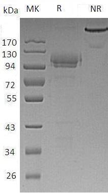 Mouse Cadm1/Igsf4/Necl2/Ra175 (Fc tag) recombinant protein