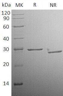 Human CFD/DF/PFD (His tag) recombinant protein