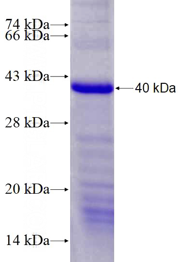 Recombinant Human C17orf71 SDS-PAGE