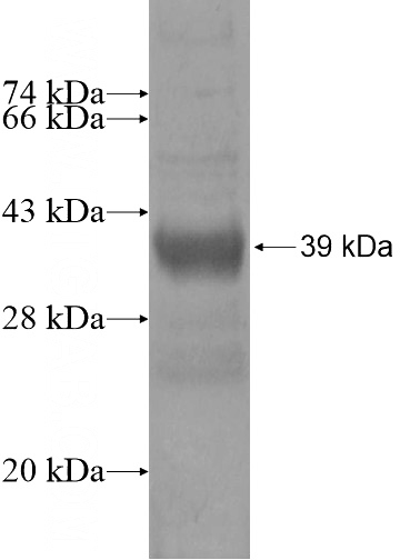 Recombinant Human KRTAP4-1 SDS-PAGE