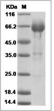 Rat CD32a / Fc gamma RIIA / FCGR2A Protein (Fc Tag)