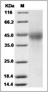 Human TMUB2 Protein (His Tag) SDS-PAGE