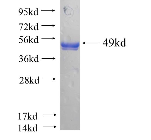 Recombinant human PHYHIPL(Full length) SDS-PAGE
