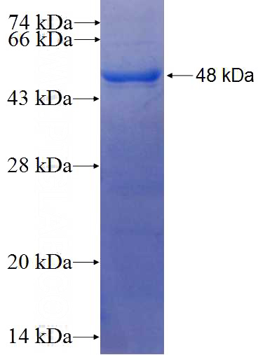 Recombinant Human ADRM1 SDS-PAGE
