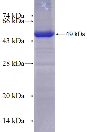 Recombinant Human EIF4A2 SDS-PAGE