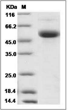 Human CD177 / PRV-1 / PRV1 Protein (His Tag) SDS-PAGE