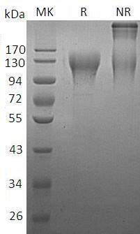 Human CD96 (His tag) recombinant protein