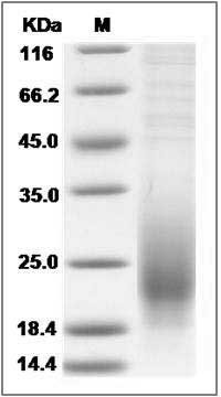 Mouse CD53 Protein (aa 107-181, His Tag) SDS-PAGE