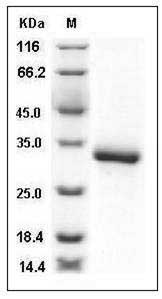 Human XEDAR / EDA2R Protein (His Tag) SDS-PAGE