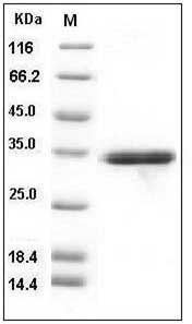Human IL-1 beta / IL1B Protein (pro form, His Tag) SDS-PAGE